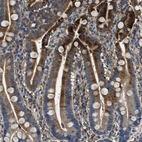 Anti-BLOC1S1 Antibody