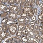 Immunohistochemical staining of human kidney shows moderate cytoplasmic positivity in cells in tubules.