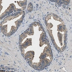 Immunohistochemical staining of human prostate shows moderate cytoplasmic positivity in glandular cells.