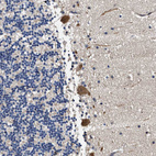 Immunohistochemical staining of human Cerebellum shows strong granular cytoplasmic positivity in Purkinje cells.