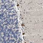 Immunohistochemical staining of human Cerebellum shows strong granular cytoplasmic positivity in Purkinje cells.