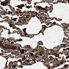 Immunohistochemical staining of human Lung shows strong granular cytoplasmic positivity in pneumocytes and macrophages.