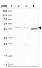 Lane 1: Marker [kDa] 230, 130, 95, 72, 56, 36, 28, 17, 11_br/_Lane 2: Human cell line RT-4_br/_Lane 3: Human cell line U-251MG sp_br/_Lane 4: Human plasma (IgG/HSA depleted)