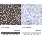 Anti-CPS1 Antibody