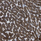 Immunohistochemical staining of human liver shows strong granular cytoplasmic positivity in hepatocytes.