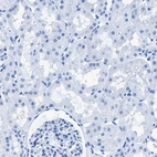 Immunohistochemical staining of human kidney shows no positivity in cells in tubules as expected.