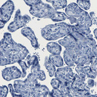 Immunohistochemical staining of human placenta shows no positivity in trophoblastic cells as expected.