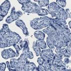 Immunohistochemical staining of human placenta shows no positivity in trophoblastic cells as expected.
