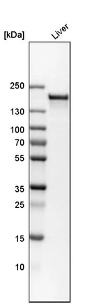 Western blot analysis in human liver tissue.