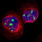 Immunofluorescent staining of human cell line A-431 shows localization to nucleoli.