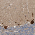 Anti-LRSAM1 Antibody
