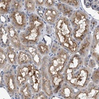 Anti-VSTM2A Antibody