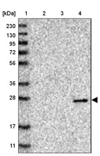 Lane 1: Marker [kDa] 230, 130, 95, 72, 56, 36, 28, 17, 11_br/_Lane 2: Human cell line RT-4_br/_Lane 3: Human cell line U-251MG sp_br/_Lane 4: Human plasma (IgG/HSA depleted)