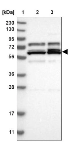 Lane 1: Marker [kDa] 230, 130, 95, 72, 56, 36, 28, 17, 11_br/_Lane 2: Human cell line RT-4_br/_Lane 3: Human cell line U-251MG sp