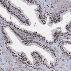 Anti-PHF12 Antibody