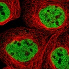 Immunofluorescent staining of human cell line A-431 shows localization to nucleoplasm.