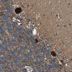 Anti-MRPL27 Antibody