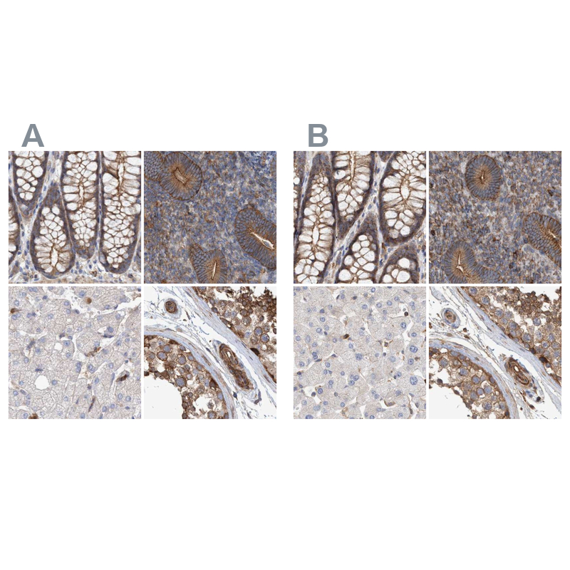 Anti-SPECC1 Antibody
