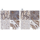 Anti-SPECC1 Antibody