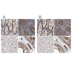 Anti-SPECC1 Antibody