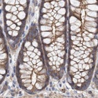 Immunohistochemical staining of human colon using Anti-SPECC1 antibody HPA021421.