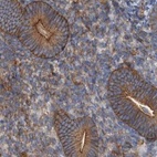 Immunohistochemical staining of human endometrium using Anti-SPECC1 antibody HPA021421.