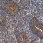 Immunohistochemical staining of human endometrium using Anti-SPECC1 antibody HPA021421.