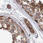 Immunohistochemical staining of human testis using Anti-SPECC1 antibody HPA021421.