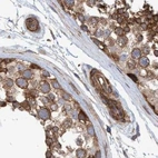 Immunohistochemical staining of human testis using Anti-SPECC1 antibody HPA021421.