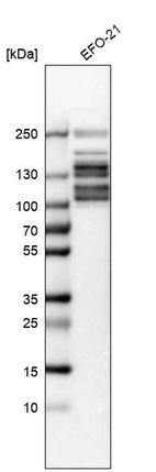 Western blot analysis in human cell line EFO-21.