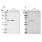 Western blot analysis using Anti-ERAL1 antibody HPA021425 (A) shows similar pattern to independent antibody HPA024423 (B).