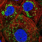 Immunofluorescent staining of human cell line A-431 shows localization to mitochondria.