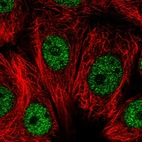 Immunofluorescent staining of human cell line MCF7 shows localization to nucleoplasm.