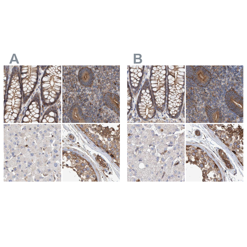Anti-SPECC1 Antibody