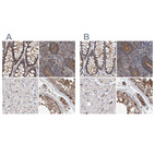 Anti-SPECC1 Antibody