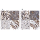 Anti-SPECC1 Antibody