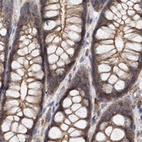 Immunohistochemical staining of human colon using Anti-SPECC1 antibody HPA021430.