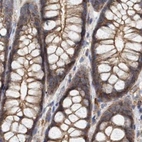 Immunohistochemical staining of human colon using Anti-SPECC1 antibody HPA021430.