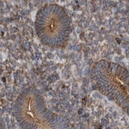 Immunohistochemical staining of human endometrium using Anti-SPECC1 antibody HPA021430.