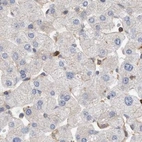 Immunohistochemical staining of human liver using Anti-SPECC1 antibody HPA021430.