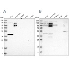 Western blot analysis using Anti-SPECC1 antibody HPA021430 (A) shows similar pattern to independent antibody HPA021421 (B).