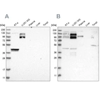 Western blot analysis using Anti-SPECC1 antibody HPA021430 (A) shows similar pattern to independent antibody HPA021421 (B).