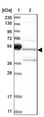 Lane 1: Marker [kDa] 230, 130, 95, 72, 56, 36, 28, 17, 11_br/_Lane 2: Human cell line RT-4