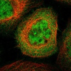 Immunofluorescent staining of human cell line A-431 shows localization to nucleoplasm & cytosol.