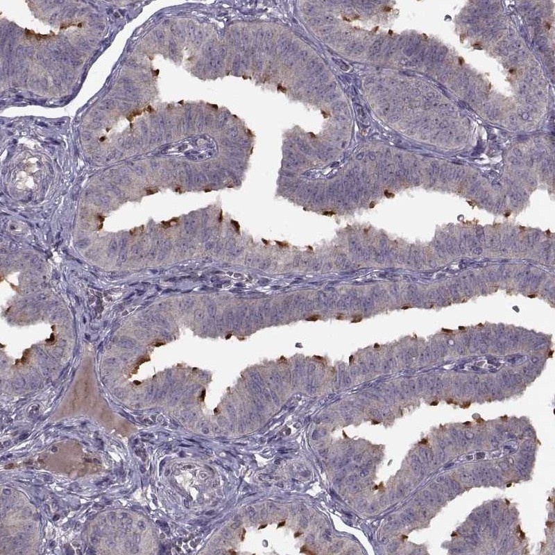 Anti-C9orf116 Antibody