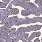 Anti-C9orf116 Antibody