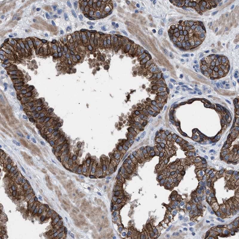 Anti-AK8 Antibody