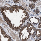 Anti-AK8 Antibody
