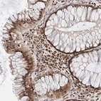 Anti-ATXN7L1 Antibody