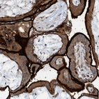 Immunohistochemical staining of human placenta shows strong membranous positivity in trophoblastic cells.